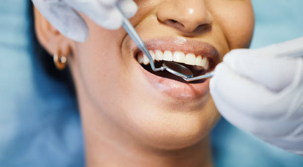 Best Emergency Dentist for Lost Fillings or Crowns in Carolina Shores, NC